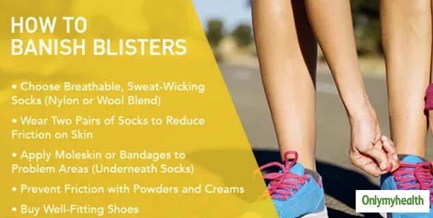 blister-care-tips-by-expert