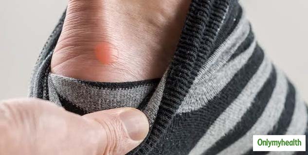 blister-care-tips