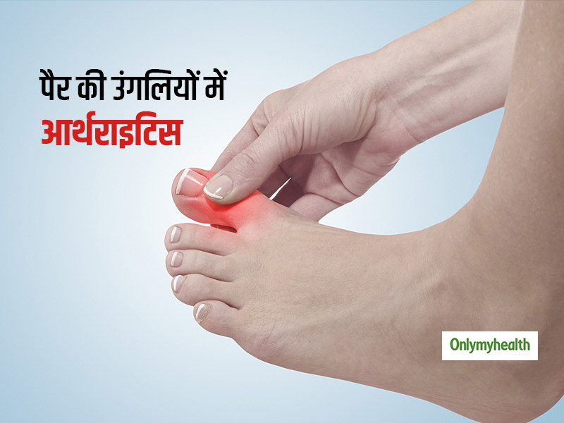 Arthritis Day 2020: पैर की उंगलियों में दर्द और जकड़न हो सकता है आर्थराइटिस का संकेत, जानें इसके कारण और लक्षण