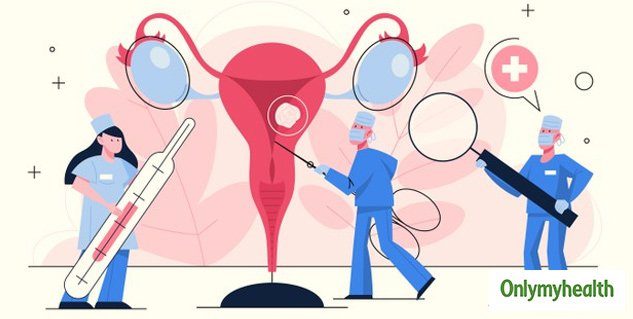 What is Fibroid Uterus Symptoms