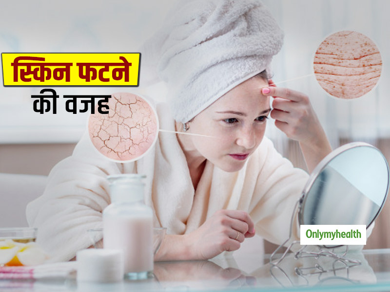 जानिए शरीर में किस कमी की वजह से स्किन फटने लग जाती है