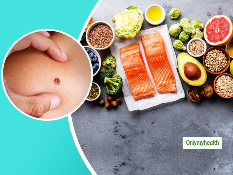 Skin Cancer Prevention: स्किन कैंसर से अपना बचाव करने के लिए डाइट में जरूर शामिल करें ये खास चीजें