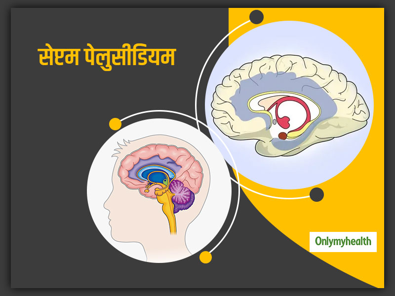Treatment Of Septum Pellucidum: जानें क्या है अब्सेंस सेप्टम पेलुसीडियम के लक्षण और इलाज