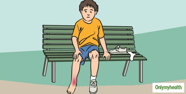 insidefractureandboneinjury