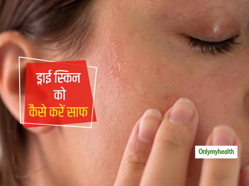 Dry Skin: रुखी त्वचा को साफ करने के लिए अपनाएं ये 6 आसान तरीके, त्वचा में हमेशा बरकरार रहेगी नमी