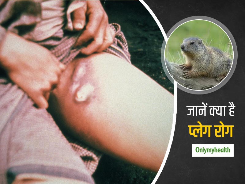 कैसे फैलता है प्लेग रोग, जानें क्या है इसके लक्षण और कितना है ये आपके लिए खतरनाक