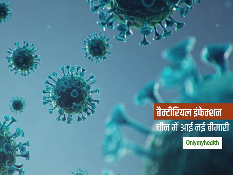 चीन में आई नई संक्रामक बीमारी, अब तक हजारों लोग हो चुके हैं इस नए बैक्टीरियल इंफेक्शन का शिकार