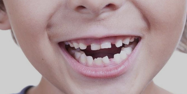 Inside2_Croockedteeth