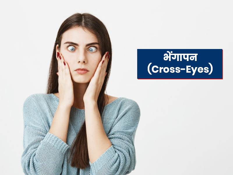 Cross-Eyes (Strabismus): भेंगापन के पीछे हो सकते हैं ये 10 कारण, जानें लक्षण, प्रकार और उपचार