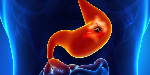 Inside1GastrointestinalBleeding