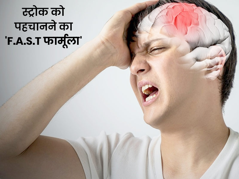 स्ट्रोक को पहचानने में मदद कर सकता है ये 'F.A.S.T फॉर्मूला', जानें क्या है ये और स्ट्रोक से बचाव के उपाय