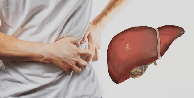 gall stones