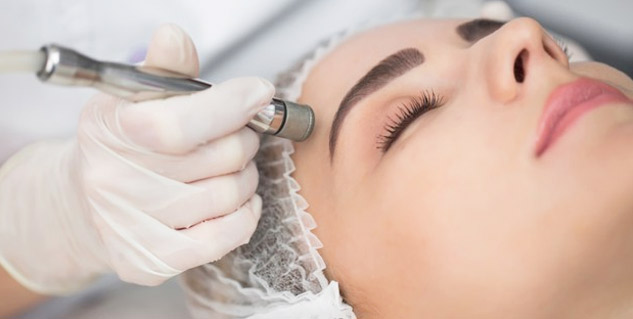 microdermabrasion benefits