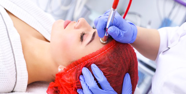 microdermabrasion side effects