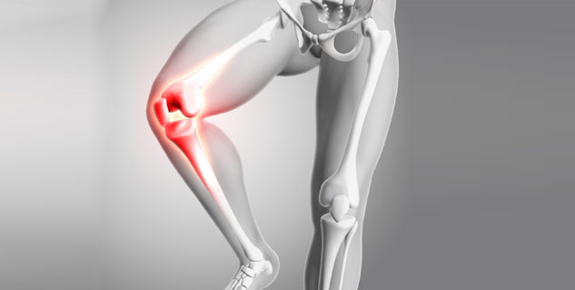 bone fracture problem