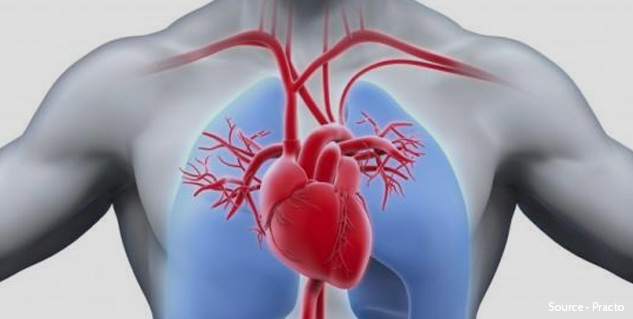 Cardiac-CT-Scan