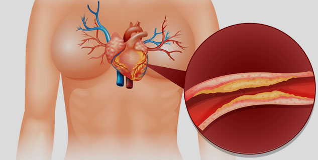 Gut-Heart-Connection