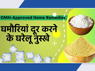 OMH Approved: गर्म&zwj;ियों में होने वाली घमौर&zwj;ियां को ठीक करने के 3 घरेलू उपाय, देखें वीड&zwj;ियो