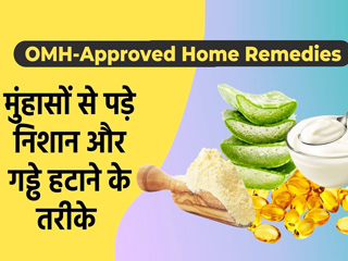 OMH Approved :  चेहरे के गड्ढ़ाें काे हटाने के लिए अपनाएं ये घरेलू उपाय
