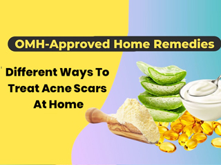 OMH-Approved Home Remedies To Erase Acne Scars