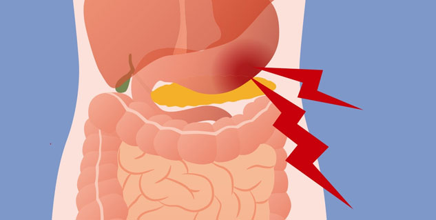 Hernia treatment