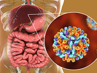 हेपेटाइटिस (लिवर की बिमारी) के लक्षण दिखने पर आजमाएं ये 7 घरेलू उपाय