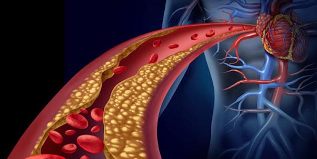 inside6howtoreducecholesterol