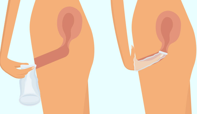 Use Of Female Condoms