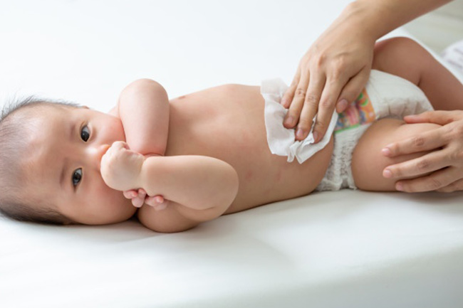 Change diapers frequently
