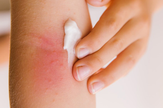 Moisturise their skin often