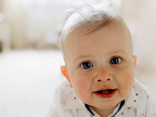 Tips By Paediatrician To Prevent Skin Infection In Babies