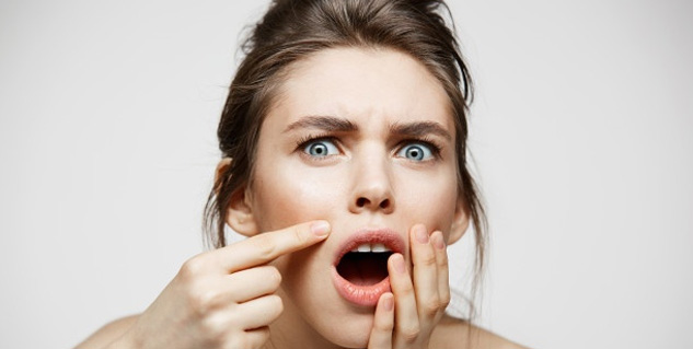 Acne-Myths-And-Facts