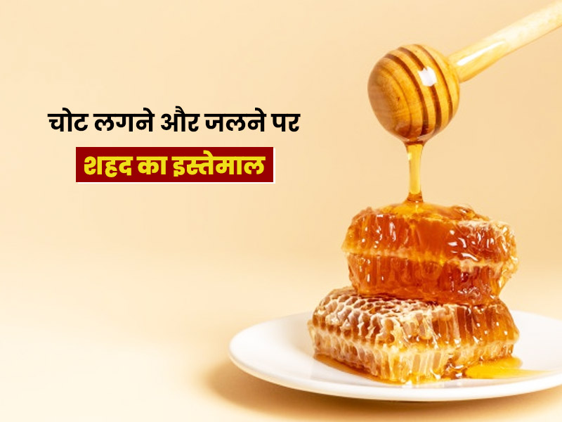 चोट लगने या गर्म चाय-दूध से मुंह जलने पर इन 3 तरीकों से इस्तेमाल करें शहद, मिलेगा जल्द आराम