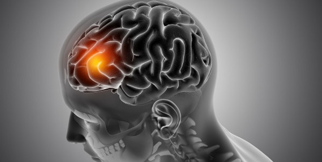 Brain-Lesions-Causes-treatment
