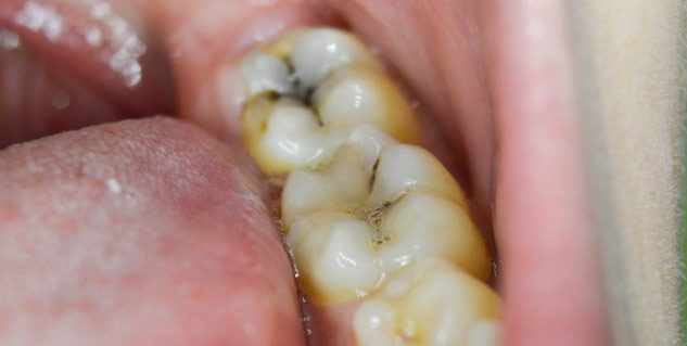 arjun ke fal ke fayde