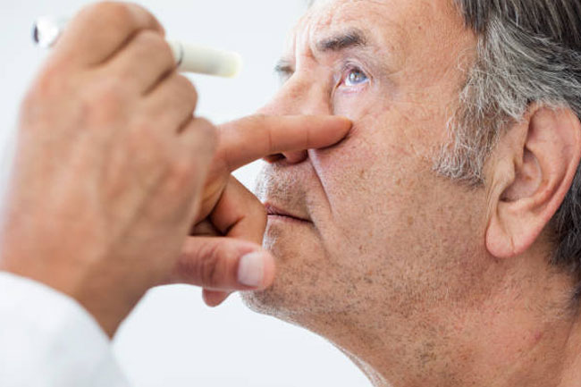 Natural ways to prevent cataract