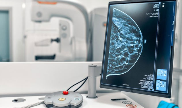 Benefits of mastectomy