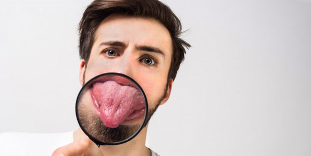 Oral manifestations of diabetes mellitus