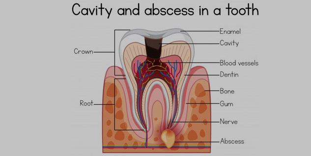 Oral Manifestations of Disorders