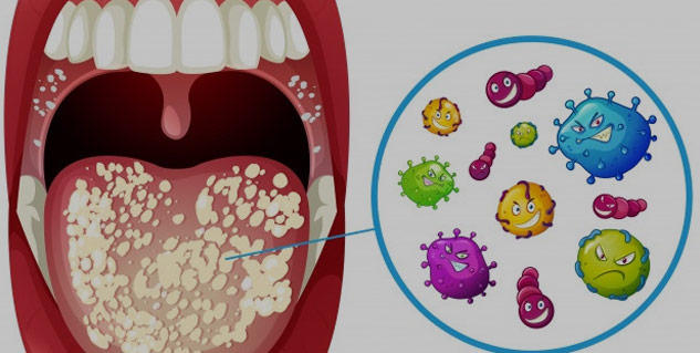 Oral Manifestations of Disorders