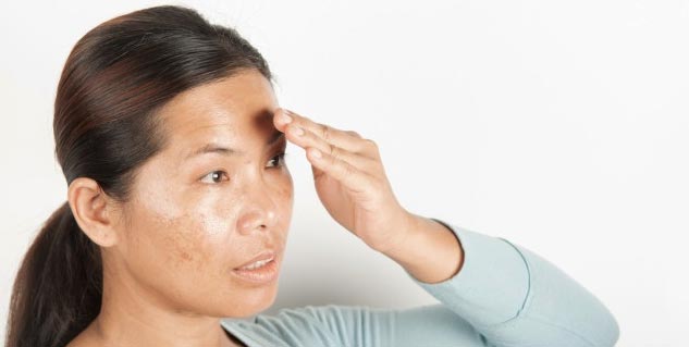 Mustard-Oil-To-Get-Rid-Of-Dark-Spots