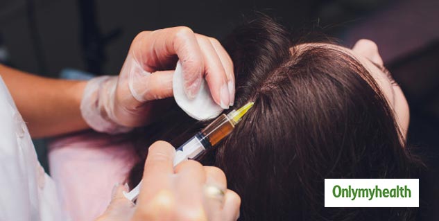 prp therapy procedure