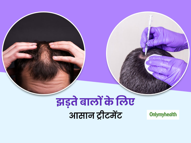 तेजी से झड़ रहे हैं आपके बाल? नए बालों के लिए करवाएं PRP Treatment