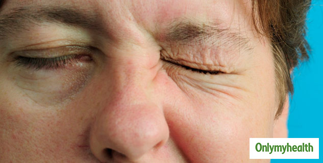 inside2eyerelatedproblems