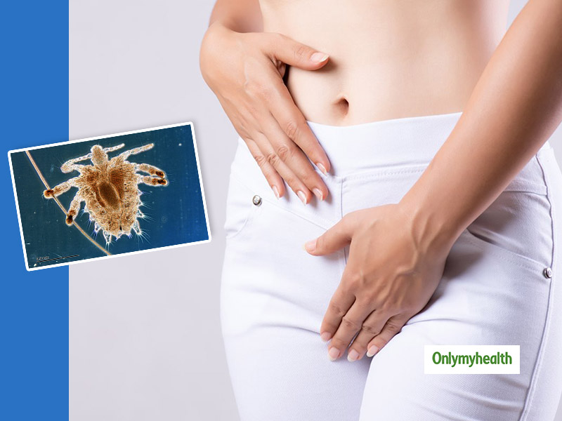 Have You Heard About Pubic Lice? Know Everything About These Insects In Your Genital Area