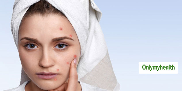 skin problem remedies