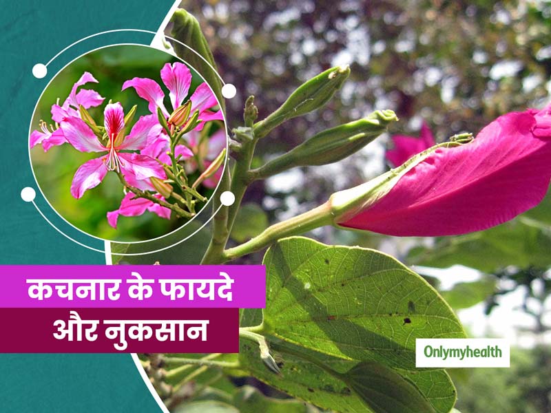 सर्दी-खांसी ही नहीं इन 11 बीमारियों को दूर करे कचनार, एक्सपर्ट से जानिए इस्तेमाल करने का तरीका और इसके नुकसान