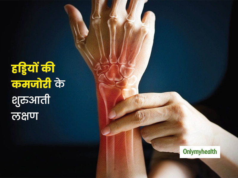 जानें हड्डियों की कमजोरी (ऑस्टियोपेनिया) के शुरुआती लक्षण और कारण, साथ ही मजबूत हड्डी के लिए डाइट प्लान