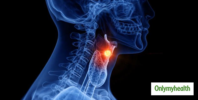 secondary bone cancer