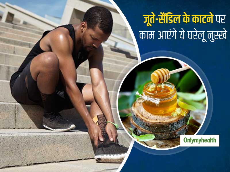 गलत जूते और सैंडल के कारण पैरों में हो सकते हैं घाव और लालपन, एक्सपर्ट से जानें इसके लिए 9 घरेलू नुस्खे